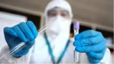 Şanlıurfa İl Sağlık Müdürlüğü: Koronavirüs testleri için kullanılan kitler arızalı çıktı Şanlıurfa İl Sağlık Müdürlüğü: Koronavirüs testleri için kullanılan kitler arızalı çıktı