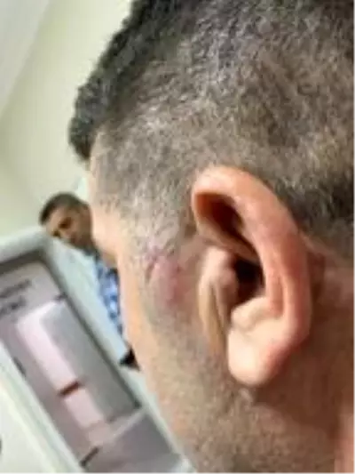 Darp edilen AK Partili Meclis Üyesi Can: Azmettirici belediye başkanı Darp edilen AK Partili Meclis Üyesi Can: Azmettirici belediye başkanı