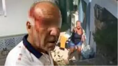'Kiracısınız, bu yolu kullanamazsınız' gerekçesiyle yaşlı adama saldırdılar 'Kiracısınız, bu yolu kullanamazsınız' gerekçesiyle yaşlı adama saldırdılar