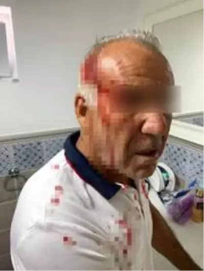 'Kiracısınız, bu yolu kullanamazsınız' gerekçesiyle yaşlı adama saldırdılar 'Kiracısınız, bu yolu kullanamazsınız' gerekçesiyle yaşlı adama saldırdılar