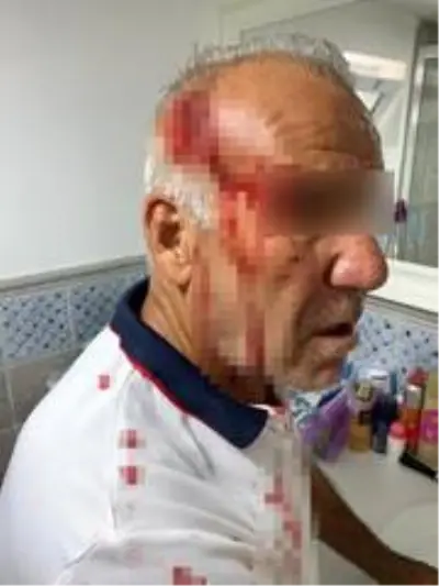'Kiracısınız, bu yolu kullanamazsınız' gerekçesiyle yaşlı adama saldırdılar 'Kiracısınız, bu yolu kullanamazsınız' gerekçesiyle yaşlı adama saldırdılar
