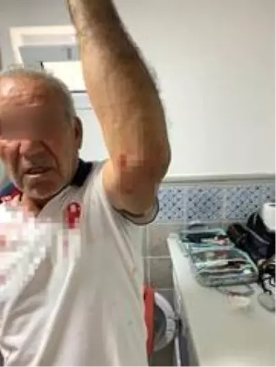 'Kiracısınız, bu yolu kullanamazsınız' gerekçesiyle yaşlı adama saldırdılar 'Kiracısınız, bu yolu kullanamazsınız' gerekçesiyle yaşlı adama saldırdılar