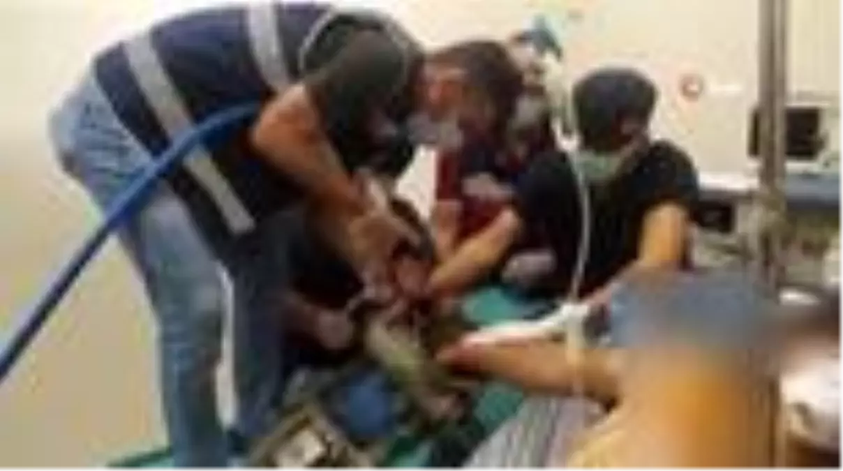Eli Salca Makinasina Sikisan Genc Icin Doktorlar Ve Itfaiye Seferber Oldu Haberler 3 Sayfa