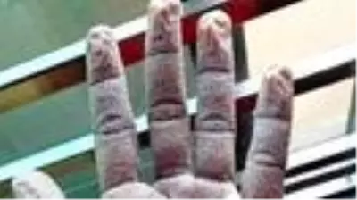 Çapa'da görevli doktorun elinin görüntüsü sosyal medyada gündem oldu Çapa'da görevli doktorun elinin görüntüsü sosyal medyada gündem oldu