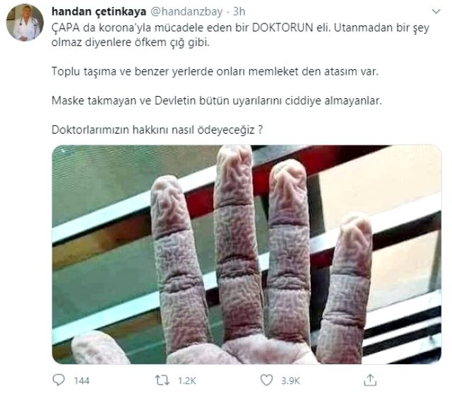 Çapa'da görevli doktorun elinin görüntüsü sosyal medyada gündem oldu