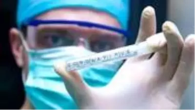 ABD'den Rusya'nın geliştirdiği koronavirüs aşına ilk yorum: Önemli olan aşının güvenli olması ABD'den Rusya'nın geliştirdiği koronavirüs aşına ilk yorum: Önemli olan aşının güvenli olması