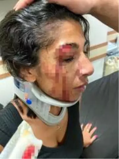 Bodrum'da kadınlar arasındaki 'Niye bakıyorsunuz' kavgası kanlı bitti: 2 yaralı Bodrum'da kadınlar arasındaki 'Niye bakıyorsunuz' kavgası kanlı bitti: 2 yaralı