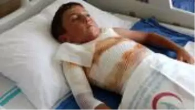 Gömleğindeki ipi yakmak isteyen çocuk kendini yaktı Gömleğindeki ipi yakmak isteyen çocuk kendini yaktı