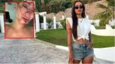 Instagram modeli Yasmine Cecilia, kendi evinde verdiği partide darp edildi! Kanlar içinde kaldı Instagram modeli Yasmine Cecilia, kendi evinde verdiği partide darp edildi! Kanlar içinde kaldı