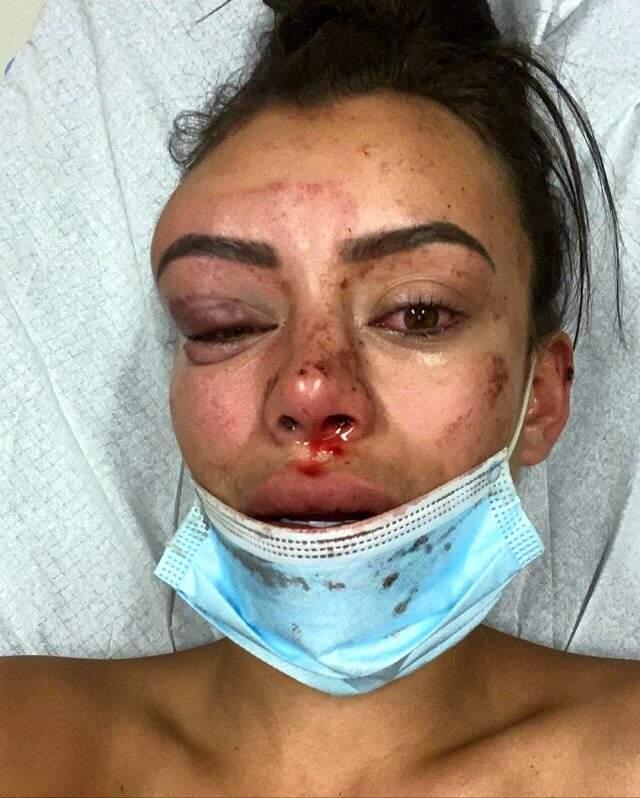 Instagram modeli Yasmine Cecilia, kendi evinde verdiği partide darp edildi! Kanlar içinde kaldı Instagram modeli Yasmine Cecilia, kendi evinde verdiği partide darp edildi! Kanlar içinde kaldı