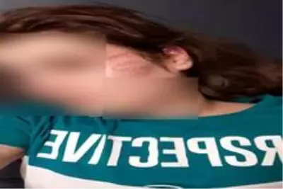 Ağabeyinin darp ettiği üniversiteli Ceylan, kendini ikinci kattan attı Ağabeyinin darp ettiği üniversiteli Ceylan, kendini ikinci kattan attı