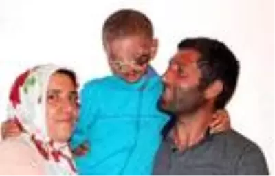 Cilt kanseri Salih'in yüzü ilk kez güldü Cilt kanseri Salih'in yüzü ilk kez güldü