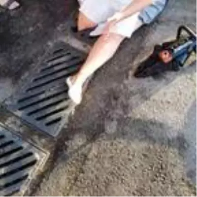 Talihsiz kadın, mazgal kapağındaki kırık nedeniyle bacağından oluyordu Talihsiz kadın, mazgal kapağındaki kırık nedeniyle bacağından oluyordu