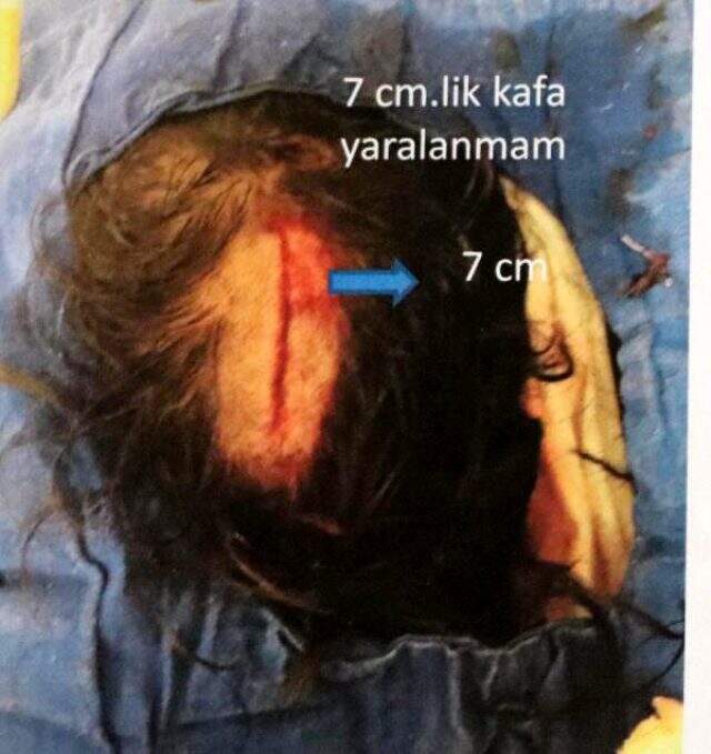 Hastanede profesörün profesöre saldırdığı anın görüntüleri ortaya çıktı