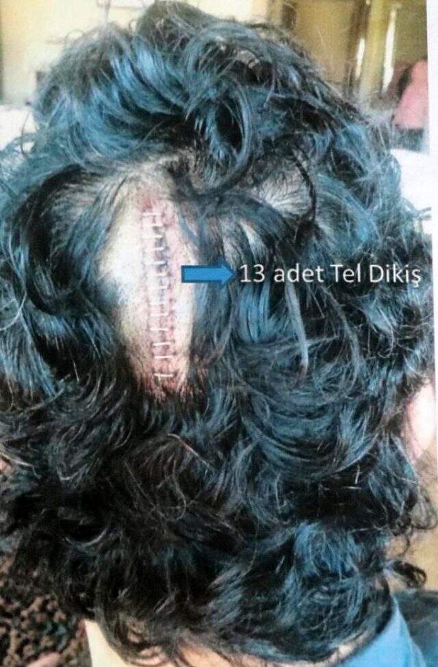 Hastanede profesörün profesöre saldırdığı anın görüntüleri ortaya çıktı