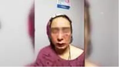 Eşi tarafından darbedilen kadın korumaya alındı Eşi tarafından darbedilen kadın korumaya alındı
