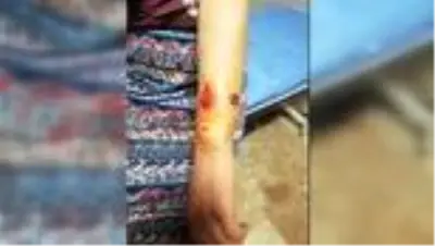 Eşi tarafından darbedilen kadın korumaya alındı Eşi tarafından darbedilen kadın korumaya alındı