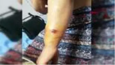 GAZİANTEP Eşinin çocuklarının gözü önünde dövdüğü Fatma, koruma altına alındı GAZİANTEP Eşinin çocuklarının gözü önünde dövdüğü Fatma, koruma altına alındı