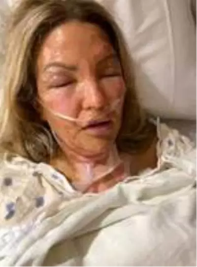 Yanan mum ile temas eden dezenfektan kutusu patladı, talihsiz kadın alevler içinde kaldı Yanan mum ile temas eden dezenfektan kutusu patladı, talihsiz kadın alevler içinde kaldı
