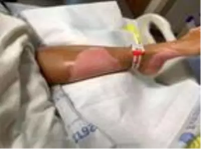 Yanan mum ile temas eden dezenfektan kutusu patladı, talihsiz kadın alevler içinde kaldı Yanan mum ile temas eden dezenfektan kutusu patladı, talihsiz kadın alevler içinde kaldı