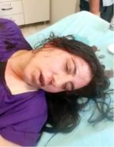 Akrabaları tarafından darbedilen kadın: Ölmeden önce sesimizi duyun Akrabaları tarafından darbedilen kadın: Ölmeden önce sesimizi duyun