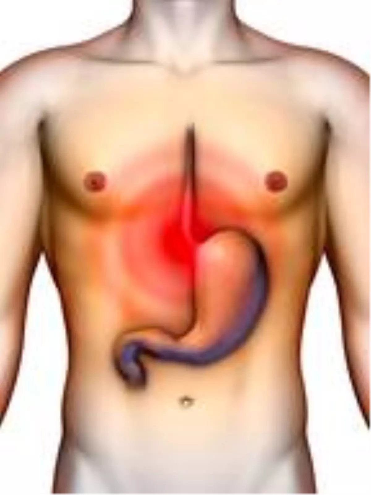 İngiltere'den gırtlak kanserini erken teşhis edebilecek araştırma