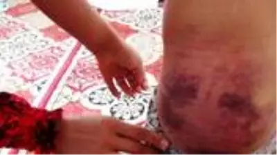4 çocuğunu eve kapatıp işkence eden baba hakkındaki soruşturma 'basit yaralama'dan yürütülüyor 4 çocuğunu eve kapatıp işkence eden baba hakkındaki soruşturma 'basit yaralama'dan yürütülüyor