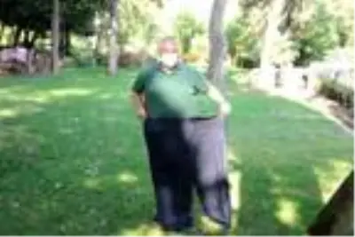 Tüp mide ameliyatı ve sporla 4 yılda 88 kilo verdi Tüp mide ameliyatı ve sporla 4 yılda 88 kilo verdi