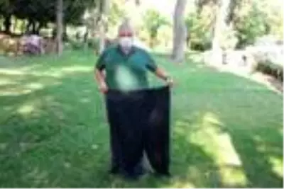 Tüp mide ameliyatı ve sporla 4 yılda 88 kilo verdi Tüp mide ameliyatı ve sporla 4 yılda 88 kilo verdi