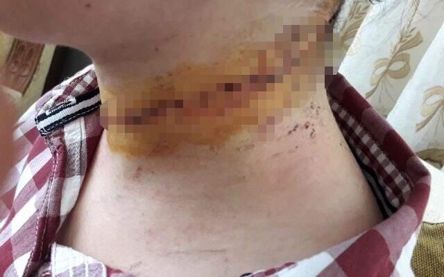 Kayseri'de gözü dönmüş adamın eşinin boğazını kesip eşarpla boğmaya çalıştığı anların yeni görüntüleri ortaya çıktı Kayseri'de gözü dönmüş adamın eşinin boğazını kesip eşarpla boğmaya çalıştığı anların yeni görüntüleri ortaya çıktı