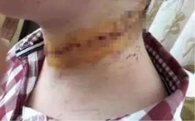 Gözü dönmüş adamın eşinin boğazını kesip eşarpla boğmaya çalıştığı anların yeni görüntüleri ortaya çıktı Gözü dönmüş adamın eşinin boğazını kesip eşarpla boğmaya çalıştığı anların yeni görüntüleri ortaya çıktı