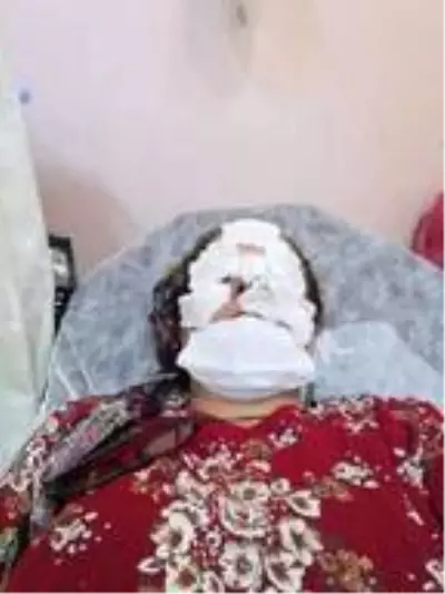 Fındık bahçesini ilaçlamak isterken zehirlenen talihsiz kadın: Yüzüme tiner atılmış gibi hissettim Fındık bahçesini ilaçlamak isterken zehirlenen talihsiz kadın: Yüzüme tiner atılmış gibi hissettim