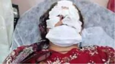 Fındık bahçesini ilaçlamak isterken zehirlenen talihsiz kadın: Yüzüme tiner atılmış gibi hissettim Fındık bahçesini ilaçlamak isterken zehirlenen talihsiz kadın: Yüzüme tiner atılmış gibi hissettim