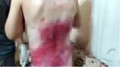 Kelebek hastası çocuklarına dokunamaya anne-babanın bir isteği var Kelebek hastası çocuklarına dokunamaya anne-babanın bir isteği var
