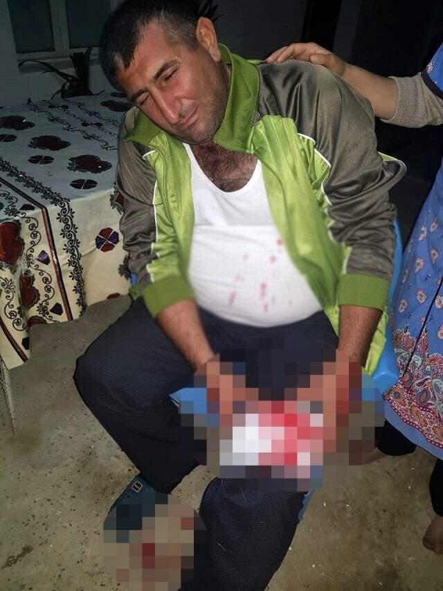 Ermenistan'ın havanlarla hedef aldığı Azerbaycanlı sivillere ait ilk foto0ğraflar yayınlandı