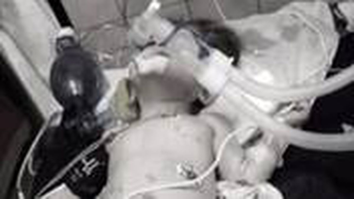 Vücudunda yanık ve yara izleriyle hastaneye kaldırılan 1 yaşındaki 'Hayat' bebek hayatını kaybetti