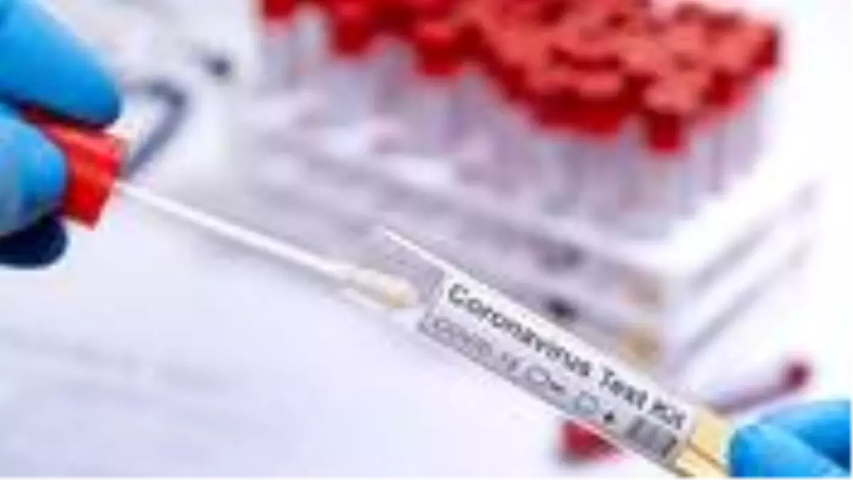 Dünya Sağlık Örgütü, düşük ve orta gelirli ülkelere 120 milyon koronavirüs hızlı test kiti sağlayacak