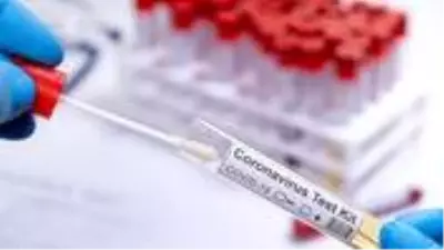 Dünya Sağlık Örgütü, düşük ve orta gelirli ülkelere 120 milyon koronavirüs hızlı test kiti sağlayacak Dünya Sağlık Örgütü, düşük ve orta gelirli ülkelere 120 milyon koronavirüs hızlı test kiti sağlayacak