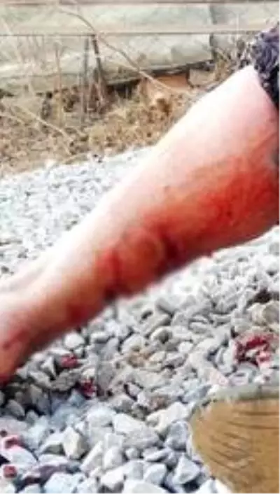 Sokak köpeğinin saldırısına uğrayan yaşlı kadın canını zor kurtardı Sokak köpeğinin saldırısına uğrayan yaşlı kadın canını zor kurtardı