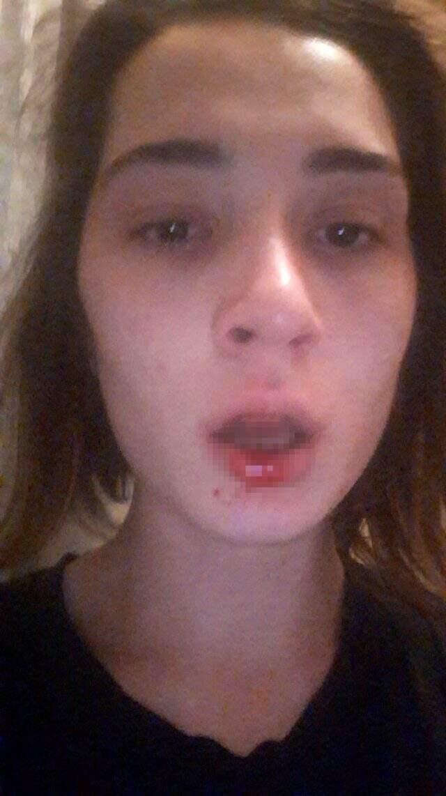 Defalarca eşinin amcasının saldırılarına maruz kalan genç kadın, sosyal medyadan yardım istedi