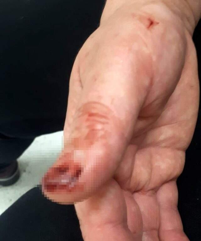 Defalarca eşinin amcasının saldırılarına maruz kalan genç kadın, sosyal medyadan yardım istedi