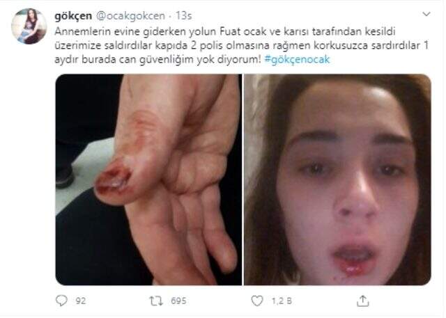 Eşinin amcası tarafından yeniden saldırıya uğrayan Gökçen Ocak: Ölmek istemiyorum