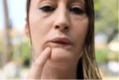 Defalarca estetik yaptıran kadının hayatı karardı! Dudağı çürüdü, yakın çevresini kaybetti Defalarca estetik yaptıran kadının hayatı karardı! Dudağı çürüdü, yakın çevresini kaybetti