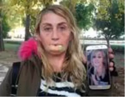 Daha güzel görünmek için defalarca estetik yaptıran kadın: Dudağımın kötü görüntüsü nedeniyle yakın çevremi kaybettim Daha güzel görünmek için defalarca estetik yaptıran kadın: Dudağımın kötü görüntüsü nedeniyle yakın çevremi kaybettim