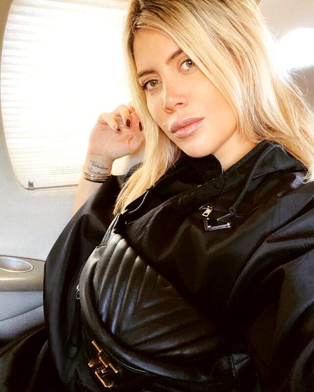 Wanda Nara'nın burnuna estetik yaptırdığı iddia edildi