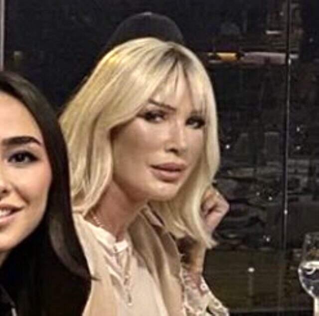 yaptirdigi estetikle olay olan seda sayan stilini de degistirdi iste yeni hali haberler magazin