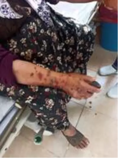 Son dakika haberi! Bozcaada�da Kangal kırması köpek tavukları öldürüp