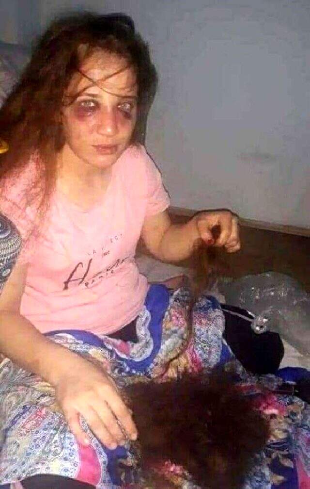 Kocasından şiddet gören kadın dehşet anlarını anlattı: 'Eşik gibi dövüyorum' diyordu