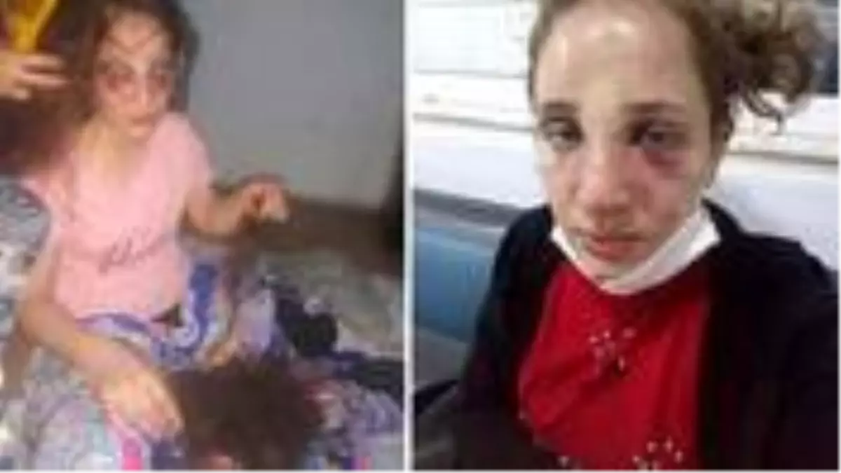 Eşinin saçlarını yolup işkence yapan kocaya elektronik kelepçe cezası verildi