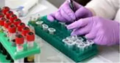 RBC nedir? Kan tahlilinde RBC düşüklüğü ve yükseliği ne anlama gelir? Eritrosit değerleri ölçümü nasıl olmalıdır? RBC nedir? Kan tahlilinde RBC düşüklüğü ve yükseliği ne anlama gelir? Eritrosit değerleri ölçümü nasıl olmalıdır?